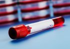FTA-ABS Blood Test
