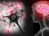 A Popular Drug Increases Alzheimer’s-Associated Plaques