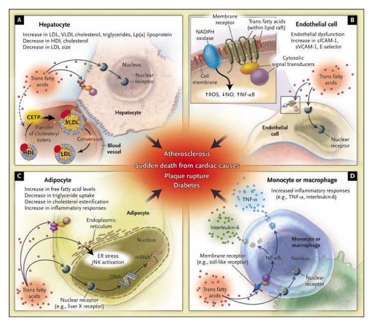 Trans fats and cardiovascular health: What is the current situation?